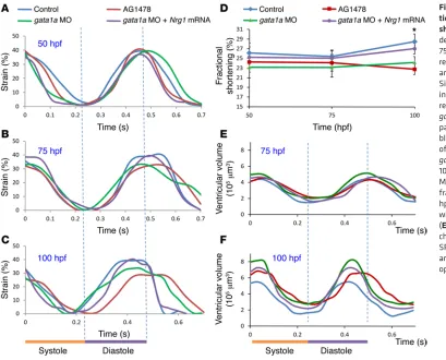 Figure 8. Effects of trabecula-tion on strain and fractional 