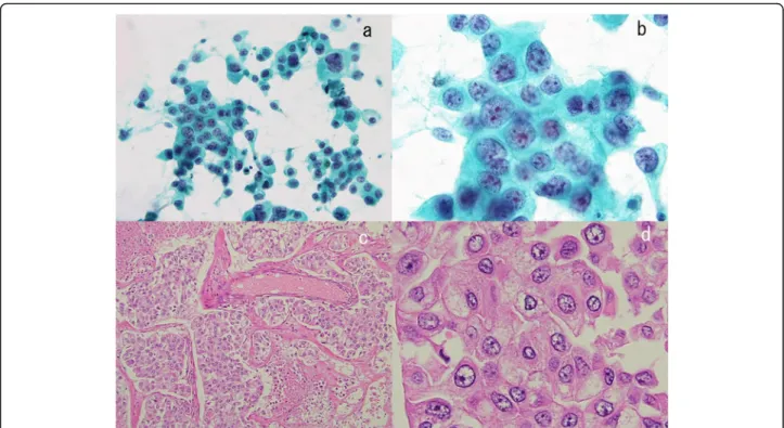 Fig. 7 Pathological findings in a stage IV patient with complete remission (CR), shown in Fig