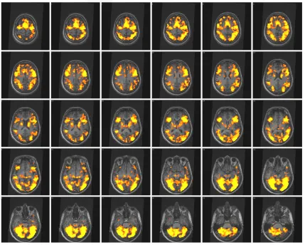 Table 12: Different regions of cortical activation and number of voxels, Brand1 young vs baseline