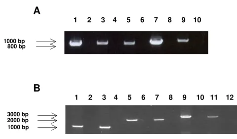 Figure 5RT-PCR amplificationRT control. Lane 3 CH15; Lane 4 CH15 no RT control. Lane 5 CH25