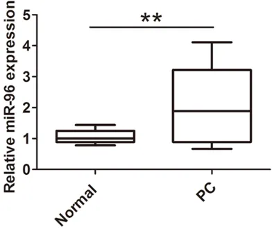 Figure 1. MiR-96 was up-regulated in prostate can-cer tissues compared with adjacent normal tissues, the expression of miR-96 was analyzed by qRT-PCR