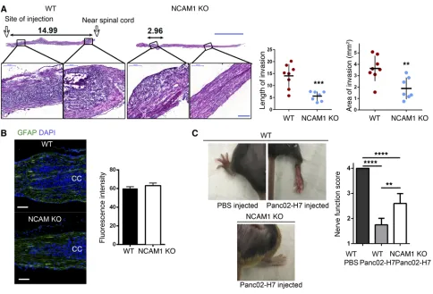 Figure 11. NCAM1 expression by Schwann cells promotes cancer cell invasion in vivo. (A) Histological analysis of injected murine sciatic nerves in WT and NCAM1 KO mice showing longer lengths of nerve invasion in WT mice
