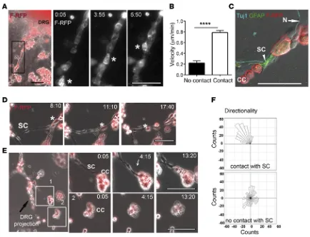 Figure 3. Schwann cells recruit cancer cells to DRG neurites. (mental Video 1, C and D)