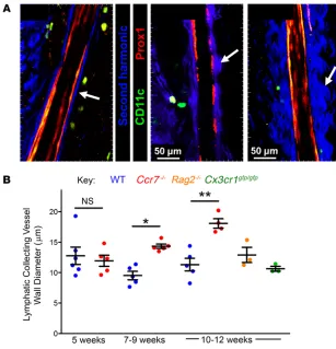 Figure 2. Increased adventitial wall thickness in lym-phatic collecting vessels of Ccr7 mice