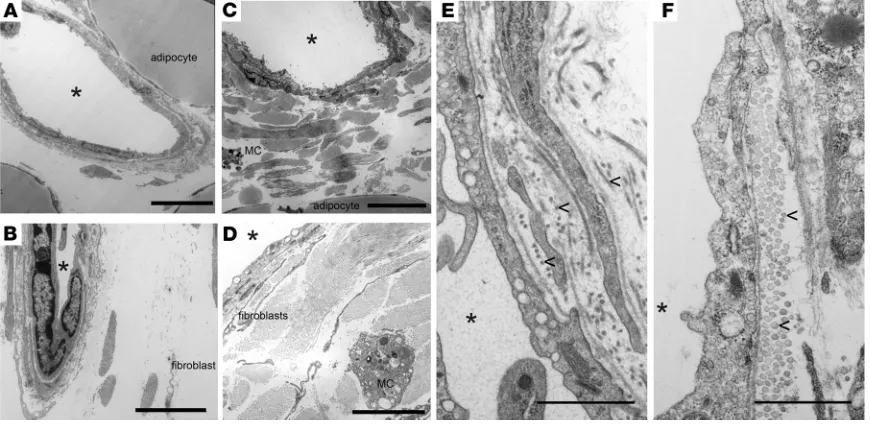 Figure 3. Electron micrographs of lymphatic collecting vessels within afferent s.c. adipose tissue near the brachial LNs from Ccr7electron microscopy