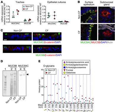 Figure 1. CF does not have major changes in airway mucin or ASL glycan composition. (A) MUC5AC and MUC5B mRNA in trachea and primary epithelial cultures (data points are from individual pigs on the left and from cultures from individual pigs on the right; 