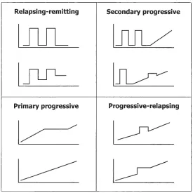 Figure 1. 1 Schematic representation of different clinical forms of MS.  