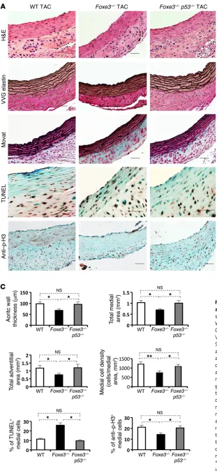 Figure 7. Loss of p53after TAC were similar to diameters of aortae from WT mice. graphs show the quantification of aortic wall thickness, total medial area, total adventitial area, medial cell density (mean number of medial cell nuclei divided by medial ar