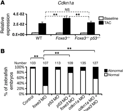 Figure 8. Loss of p53 rescues SMC loss with Foxe3 deficiency through Cdkn1a. (A) qPCR analysis of Cdkn1a mRNA expression in ascending aortae from WT, Foxe3–/–, and Foxe3–/– p53–/– mice at baseline and 2 weeks after TAC