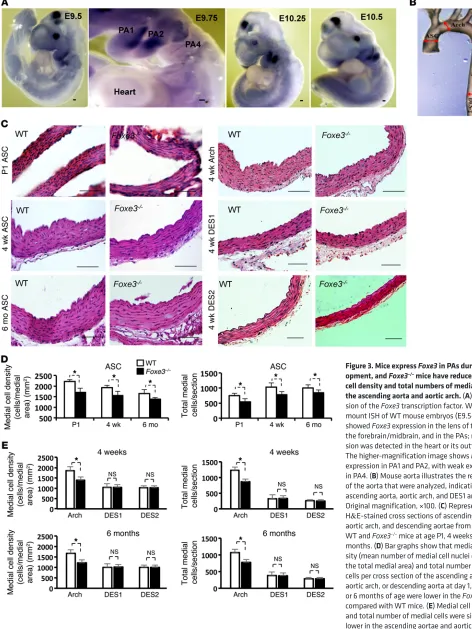 Figure 3. Mice express Foxe3 in PAs during devel-opment, and Foxe3 mice have reduced medial 