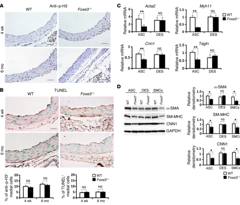 Figure 4. Foxe3of age. No differences in the percentage of TUNEL-positive cells were observed in aortae from WT and aortae and explanted SMCs from SM-MHC, and CNN1 in ascending aortae, descending aortae, and SMCs from WT and Error bars indicate SD from the