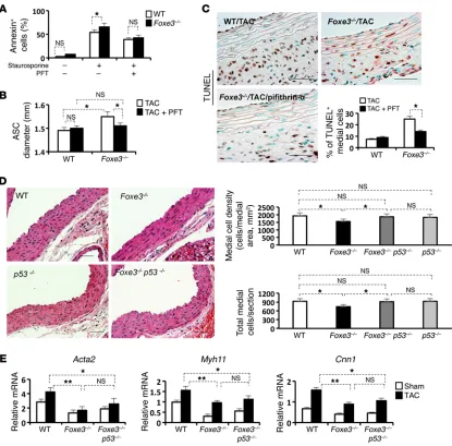 Figure 6. Aortic developmental defects and aberrant aortic remodeling with TAC in Foxe3PFT treatment