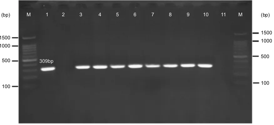 Figure 2 Gel electrophoresis of mcr-1 gene (309 bp) encoding for colistin resistance. M: 100 bp DNA marker, line 1: positive control (E