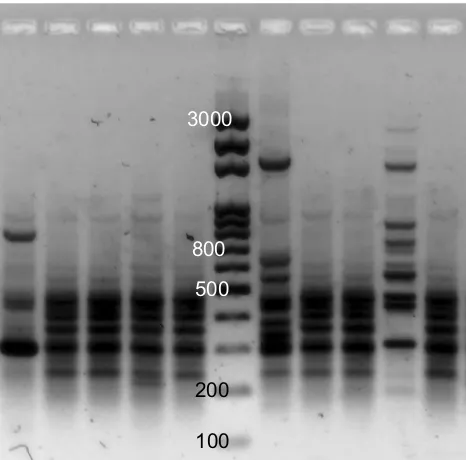 Figure 1 A representative example of ERIC-PCR pattern for clinical Pseudomonasisolates
