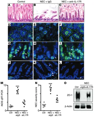 Figure 5. Inhibition of IL-17R reverses mucosal damage in NEC in mice. (A–L) WT mice were either breast fed or induced to develop NEC after injection with IgG or anti–IL-17R as indicated