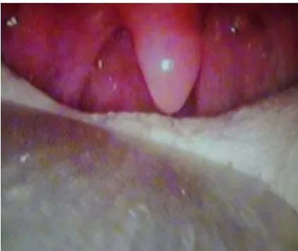Figure 4. Microscopic appearance (20×). 