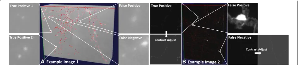 Fig. 3 Axon detection results on two challenging datasets. (a) An example of a 3D image stack of mouse neuron imaged with bright‑field microscopy (also see Fig