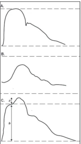 figure 1. The pulse pressure wave form. (a) The incident wave generated by the left ventricle (in  the ascending aorta)