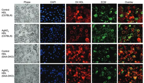 Figure 5. HDL from AgNOdoes.3-injected SAA-DKO mice does not colocalize with the adipocyte cell surface, while HDL from AgNO3-injected C57BL/6 mice  HDL from PBS- and AgNO-injected C57BL/6 and SAA-DKO mice was labeled with DiI (red)