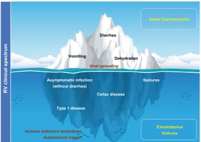 Figure 1 The “iceberg” model of Rv infection proposal: AGe and diarrhea are just the most obvious and frequent clinical picture of the pathology by Rv