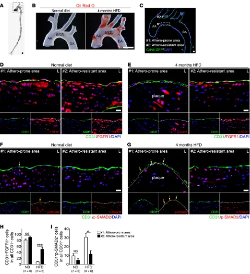 Figure 2. Shear stress downregulates FGFR1 expression and upregulates TGF-β signaling in vivo