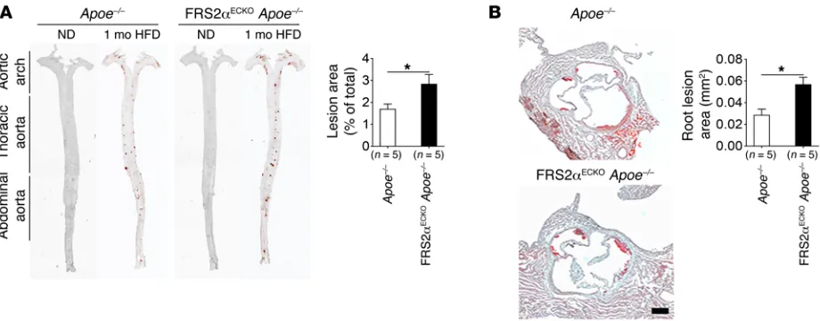 Figure 4. Effect of endothelial FGF signaling suppression on atherosclerosis in mice after 4 weeks of HFD