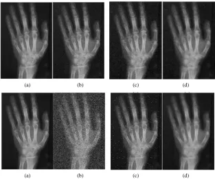 Figure 9. Histograms of images. (a) Blurred image; (b) Enhanced image. 