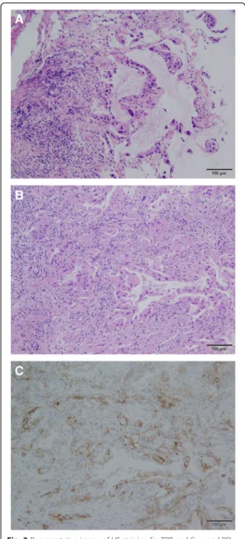 Fig. 2 Representative image of HE staining for TBB and Cryo and PD- PD-L1 ≥ 50% with the same patient (Adenocarcinoma 10×)
