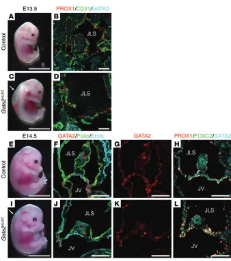 Figure 8. Lymphatic vascular phenotypes in E13.5 and E14.5 CreGata2Gata2ΔLEC embryos. Prox1- ERT2 Gata2fl/+ male mice were crossed with fl/fl female mice, and tamoxifen was administered at E10.5, E11.5, and E12.5, fol-lowed by analysis at E13.5 (A–D), or E