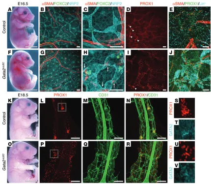 Figure 9. Lymphatic vessel valve development is perturbed in Gata2nostaining of E18.5 mesenteries demonstrated bulbous mesenteric lymphatic vessels in with littermate controls (and tamoxifen was administered at E12.5, E13.5, and E14.5