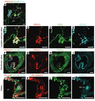 Figure 4. Localization of GATA2 in valves and arteries. (A–E) Immu-nostaining of E13.5 WT mouse tissue sections demonstrated that GATA2 is present at higher levels in the endo-thelial cells comprising LVV leaflets (E, arrows) compared with endothelial cell