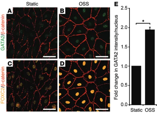 Figure 5. In vitro OSS increases GATA2 levels in hLECs. hLECs were cul-1/4 Hz) (demonstrated elevated levels of nuclear GATA2 ((to ± SEM, Student’s tured under static conditions (A and C) or subjected to OSS (4 dyn/cm2, B and D) for 48 hours