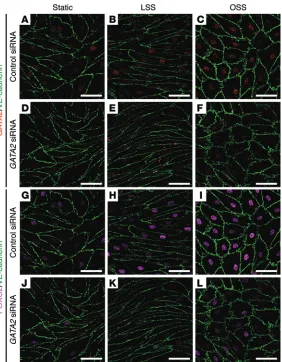 Figure 6. OSS induced elevation of FOXC2 is dependent on GATA2. hLECs were trans-fected with control or GATA2 siRNA and cultured under static (A, D, G, and J) conditions, or subjected to laminar shear stress (LSS; B, E, H, and K) or OSS (C, F, I, and L) fo