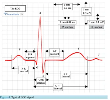 Figure 4. Typical ECG signal.                                                     