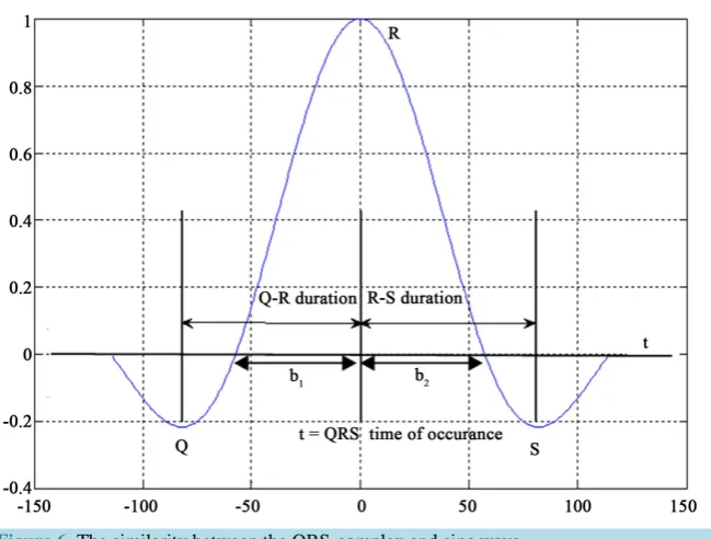 Figure 6. The similarity between the QRS-complex and sinc wave.                    