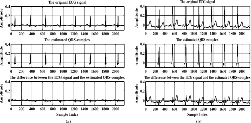Figure 10 sults presented in ECG signals and the signals differences of the two records after thresholding both of them