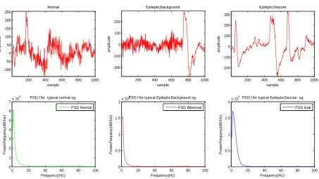Figure 1.3 PSD of typical Normal, Ictal, InterIctal  signals taken from CHB-MIT Data set  