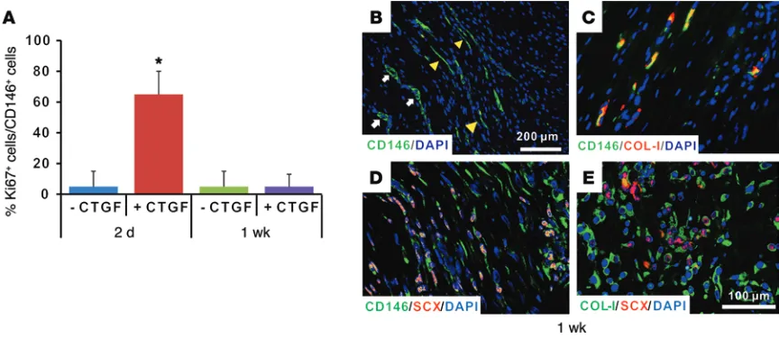 Figure 5. Proliferation and differentiation of CD146+delivery by 2 days in comparison with fibrin alone, but there was no difference at 1 week (have be spindle-shaped with aligned collagen fibers in the CTGF-delivered group (The spindle-shaped tenocyte-lik