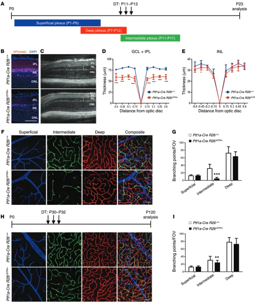 Figure 5. Genetic ablation of amacrine and horizontal cells phenocopies the defects in the intermediate plexus observed in Hif-1α and Vegfa mutants
