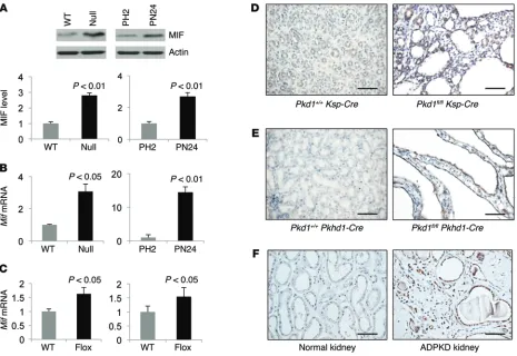 Figure 1. Pkd1sections from normal and ADPKD kidneys (well as in postnatal Mif(WT) and mutant renal epithelial cells and tissues demonstrated increased expression of MIF