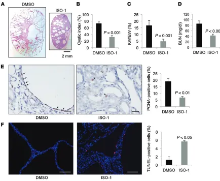 Figure 3. Treatment with ISO-1 delayed cyst growth in Pkd1(DMSO) (sections from Pnl/nl mice