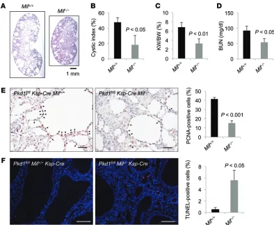 Figure 4. MIF and Pkd1mean ± SEM. Ksp-Creanalysis was performed using an unpaired 2-tailed Student’s  double KO delayed renal cyst formation