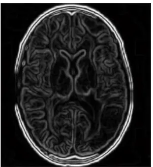 Fig -2: The original MRI Brain image.  