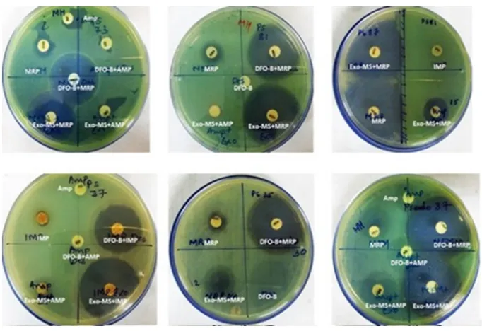 Figure 1 Susceptibility of MRSAcombinations, indicating synergism. For example, in the second row, the left plate showed no zones of inhibition with cefdinir