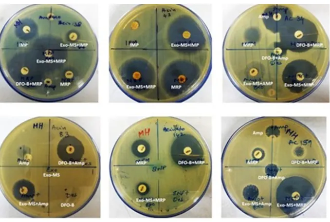 Table 2 MIC of Exo-MS for MRSA and MBL-producing Pseudomonas aeruginosa and Acinetobacter baumannii