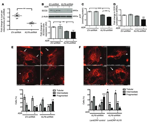 Figure 8. shRNA-mediated KLF6* knockdown increased the susceptibility to mitochondrial injury
