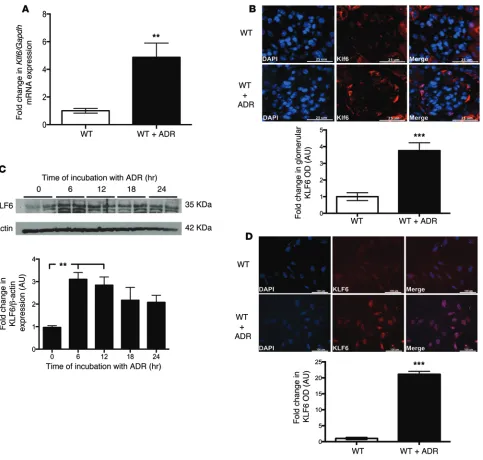 Figure 7. KLF6 expression is increased early with ADR treatment. Primary podocytes isolated from WT mice were treated with and without ADR for 12 hours