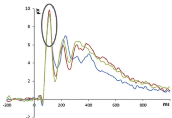 Figure 5 illustrates the P2. A repeated measures ANOVA with P2 amplitude as the dependent variable and face type (healthy vs