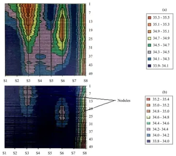 Figure 10.  123I scan-toxic multinodular images. (a) LAO view; (b) RAO view; (c) ANT view at the left side (Figure 10(c)), shows parts of the two gland lobes with 5 nodules around them, correspond-ing to nodule thermal activity in contrast to relatively lo
