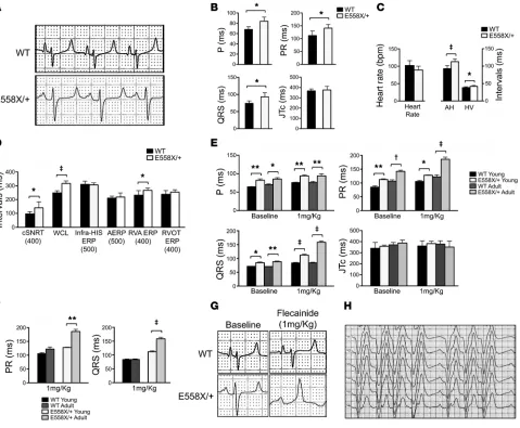 Figure 2. Electrophysiological analysis of SCN5AII) of WT and and infusion of 1 mg/kg flecainide
